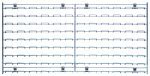The Quantum Wire Louvered Panel features a 36L x 18H chrome-plated finish with a wireframe design and comes with direct mounting clips, highlighting its structure against a white backdrop.